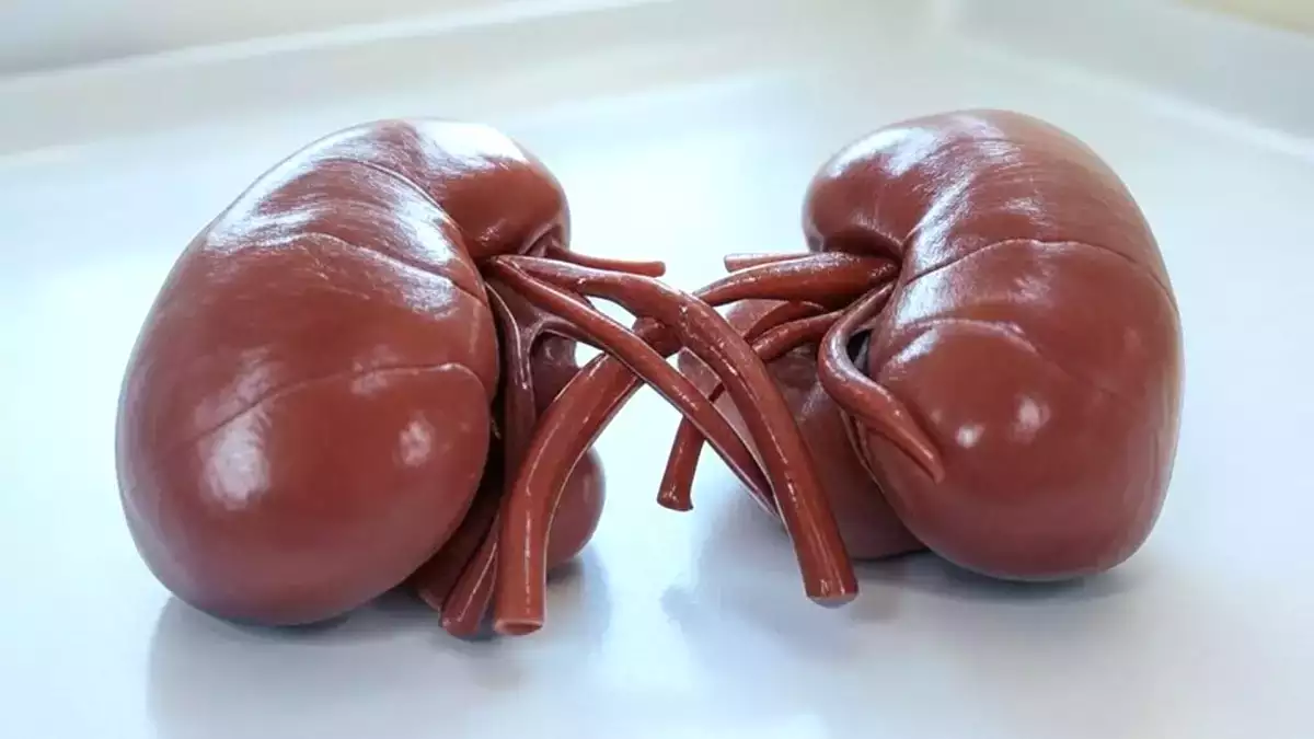 7 consejos para prevenir problemas renales graves. ¡Descúbrelos ahora para mantenerte sano!