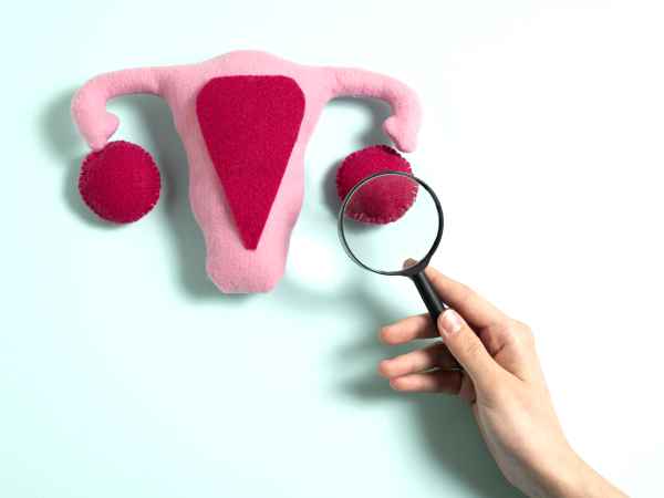 Endometriosis y alimentación: las claves para controlar mejor los síntomas