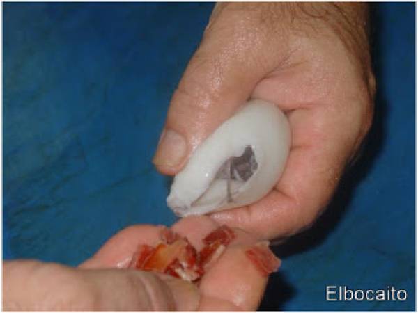 Chipirones rellenos de jamón serrano, en su tinta. - Preparación paso 2